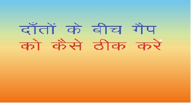 दांतों के बीच गैप या डायस्तेमा  को कैसे ठीक करें घरेलू उपाय Gharelu upay